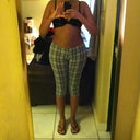 Front Day 8 Post Op