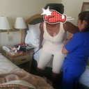 3 days PO..just fitted for compression garment.