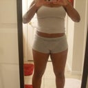 9 Days Post-Op W/Out Garment