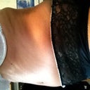 Swollen from side