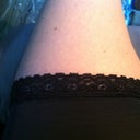 Fat legs demonstrating how the swelling begins wherever the garment ends!