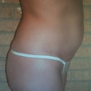 Pic before surgery