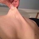loose skin above belly button