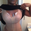 day 3 post op front side