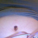cockroach belly button