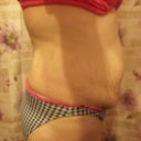 right side..3/28/12