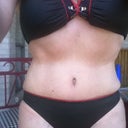 Here I am 20 weeks post op in my new suit!  Yes, I need a bikini wax but am going to the beach next week so that is scheduled for day after tomorrow.  I don't have long arms so this is the best I can do by myself. lol
