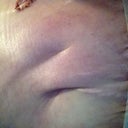 This is the pleat that is freaking me out