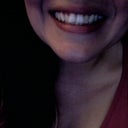 Teeth Before.