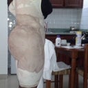 1 day post op "the massacre"