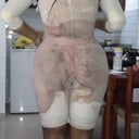 1 day post op "the massacre"