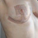 Week 5. I love how they adhere to my chest now!
