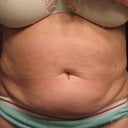 Before Front