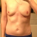 2 days after deflation