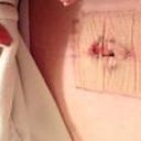 Have no idea what I did to cause this bleeding-bleeding it at the top of bellybutton.  Excuse dried blood inside bellybutton...not allowed to clean it yet :-/