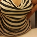 Me now 2 weeks post op