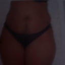 before tummy-tuck #1
