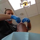 The Invisalign process starts with molds of my teeth
