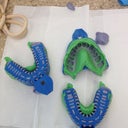The final molds of my pre-Invisaligned teeth