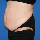 tummy left side