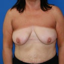 front boobies