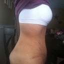 after 7 wks side