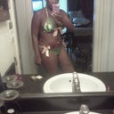 10 days post op