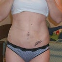 2.5 months - front