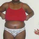 4wks post-op