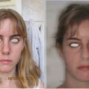 before and after