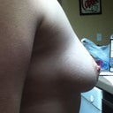 Before side view