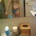 3 days post op- left-side view, no gauze