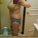 3 days post op- right-side view, no gauze