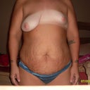 pre op