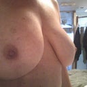 Oct 8th 2012   five days after explant