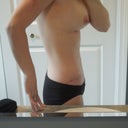 Day 31 Post Op