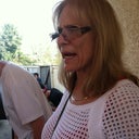 Before Picture to rid jowls and neck.