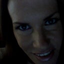 After three syringes of filler.....look at the cheek on the right