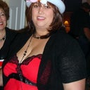 Before Weight loss