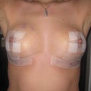New fresh tape applied.