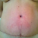 Belly post shower at almost 11 weeks. Anyone else get this?