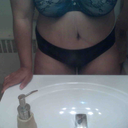 8 days post op still swollen this pic was taken towards the end of the day but it's a worlds better than it was.