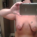 Before surgery