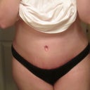 6 Weeks PO