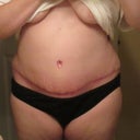 6 Weeks PO