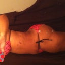 2 weeks post op