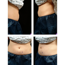 April 2010 - before 1st treatment