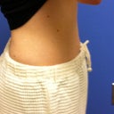 July 2011 - after 2 treatments
