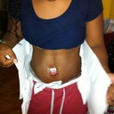 day 1 post op