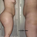 3 and 4 weeks after